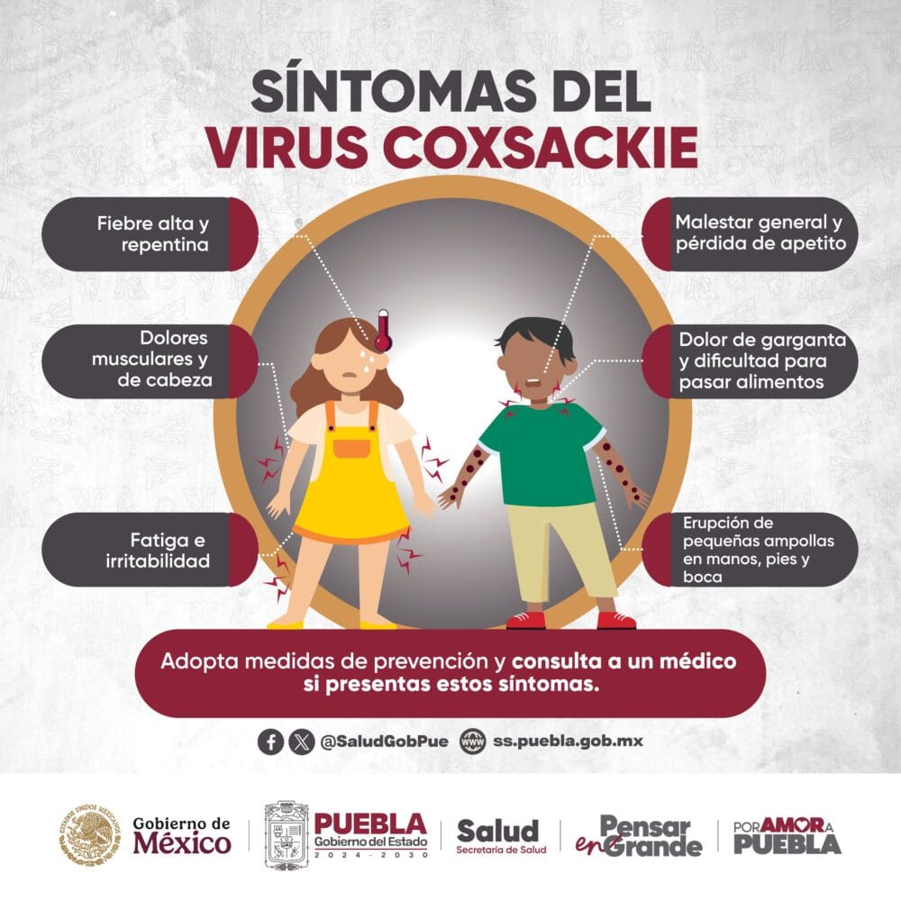 Atiende Gobierno de Puebla brote de virus coxsackie en municipios