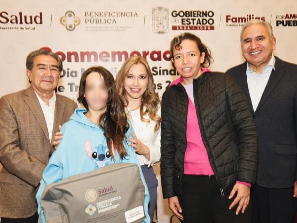 SEDIF y Beneficencia Pública Nacional transforman vidas de niñas y niños con Síndrome de Treacher Collins