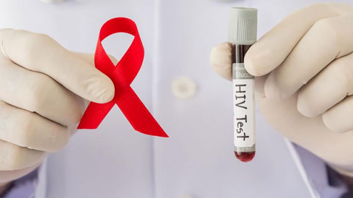 Padecen 4 mil 667 poblanos VIH-Sida y están bajo tratamiento: Salud