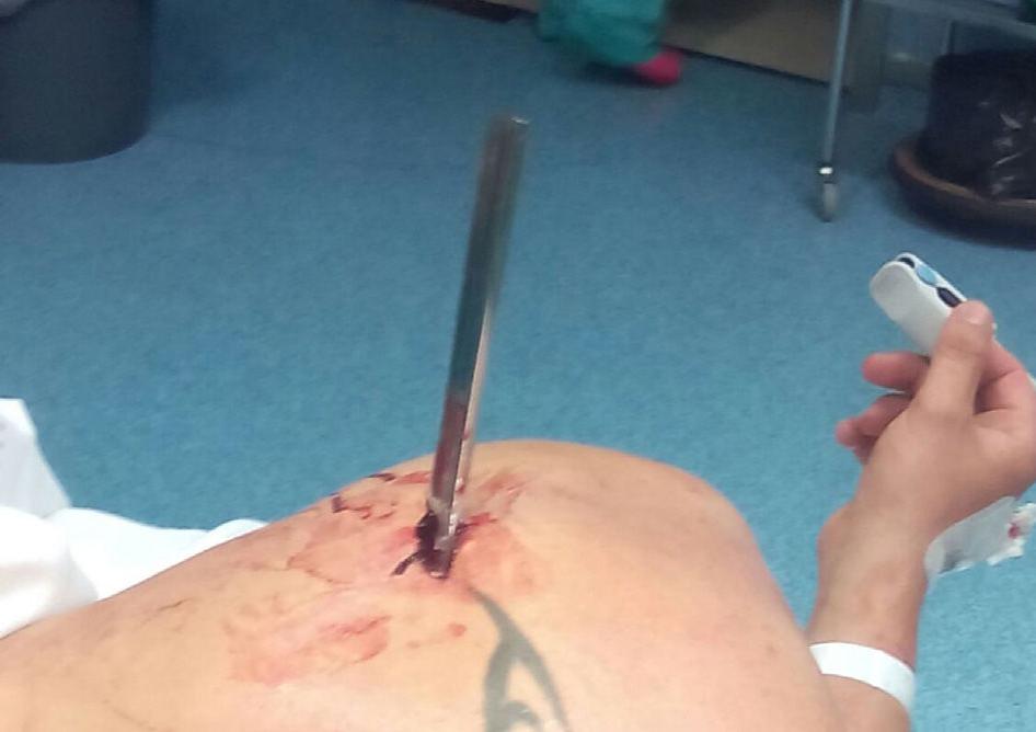 Casi 2 mil poblanos llegaron con heridas de armas a hospitales